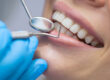Ventura dentist near me dental cleaning