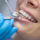Ventura dentist near me dental cleaning