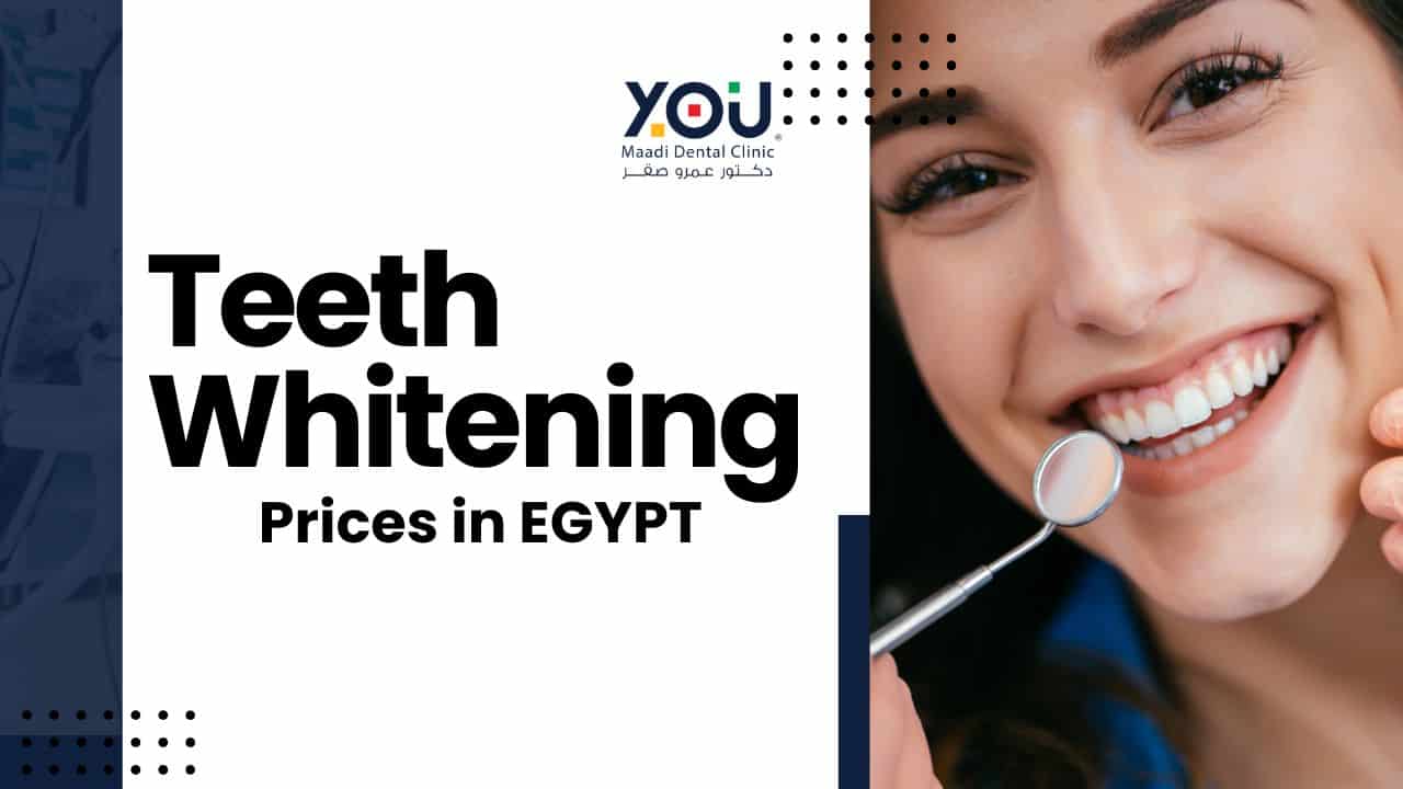 Teeth Whitening Prices in Egypt 2025