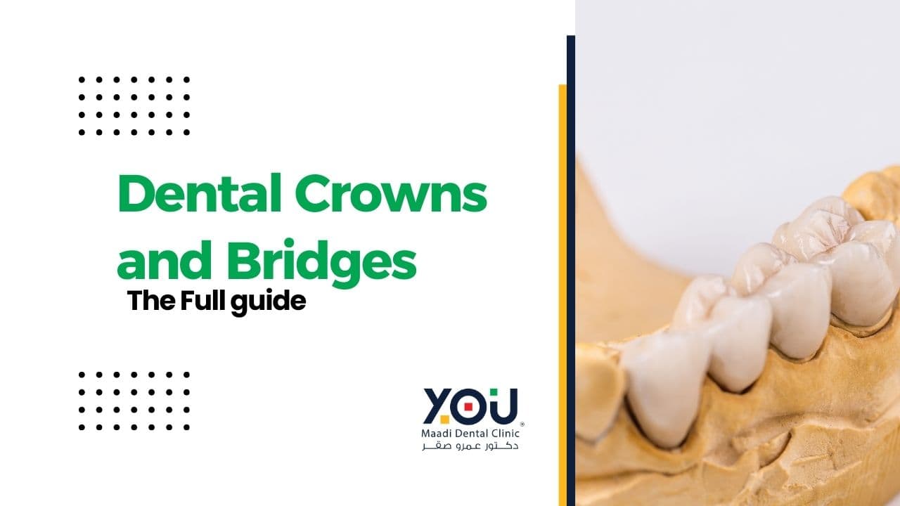 Enhance Your Smile with Crowns and Bridges at YOU Dental Clinic