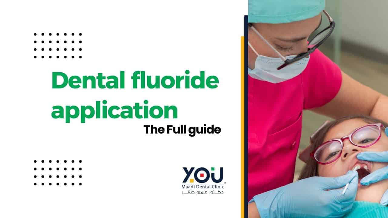 Protect Your Teeth with Fluoride Application at YOU Dental Clinic