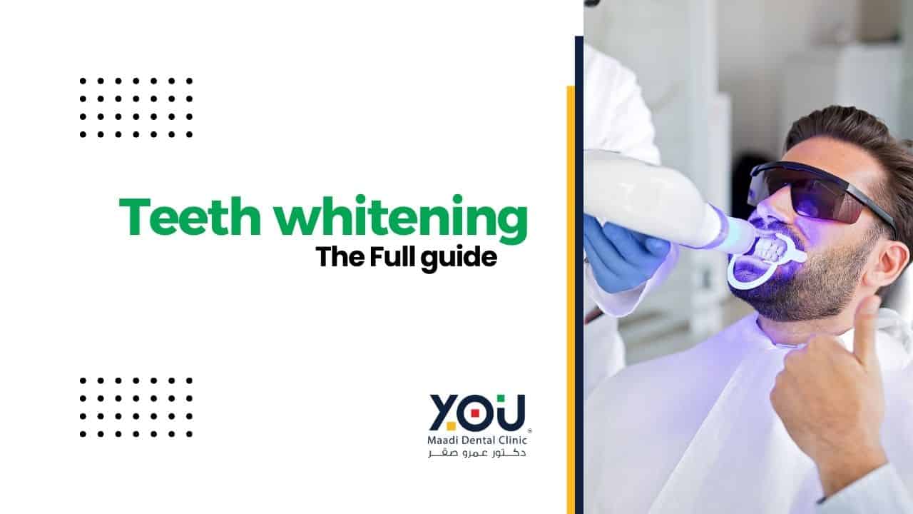 Teeth Whitening with YOU Maadi Dental Clinic