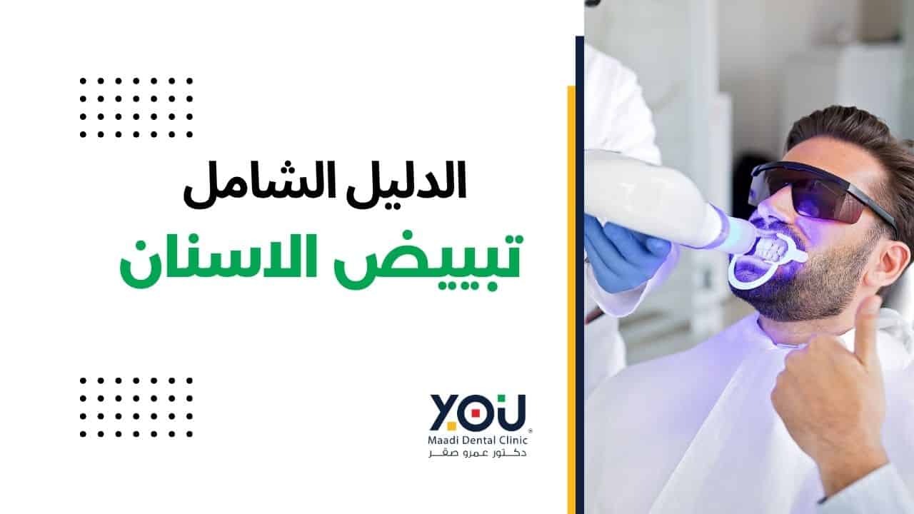 تبييض الاسنان 2025: دليل تفصيلي مع YOU Maadi Dental Clinic