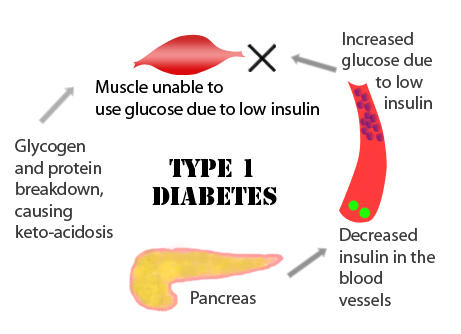 diabetes1