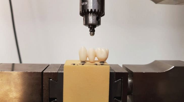 Dental Technology in Sync – CAD/CAM Integration at VCAD
