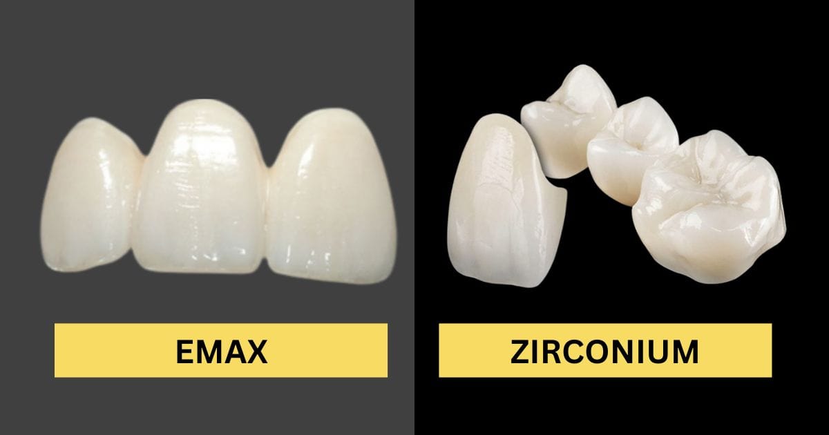 zirconia/E.max