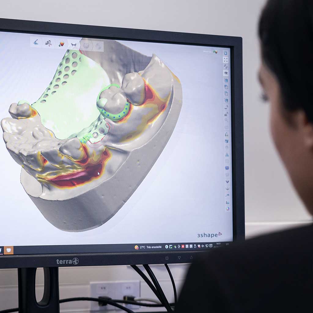 CAD CAM dental esthetics