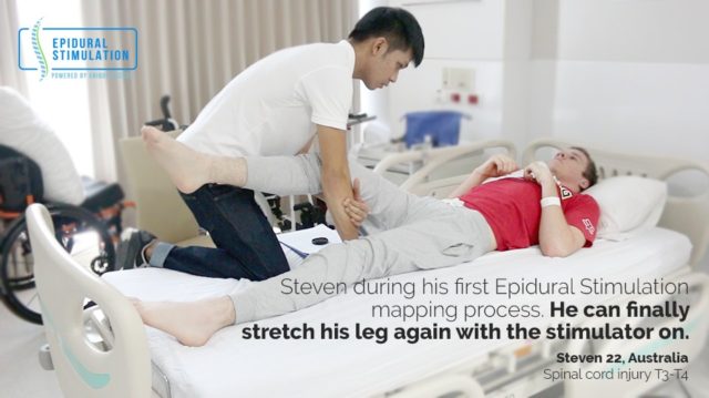 T3 Spinal Cord Injury Patient Steven - Epidural Stimulation