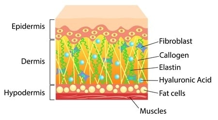 Skin layers during RF skin therapy showing dermis, collagen and fat