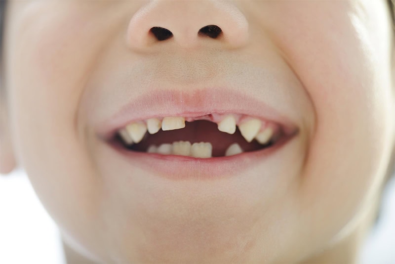 How to Make the Tooth Fairy Useful with Your Kids