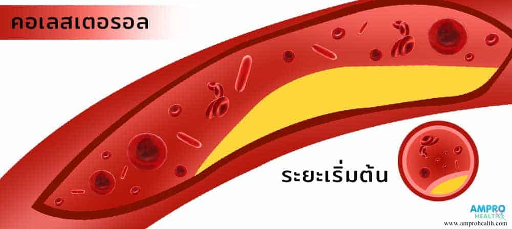 คอเลสเตอรอล คือ อะไร (Cholesterol)