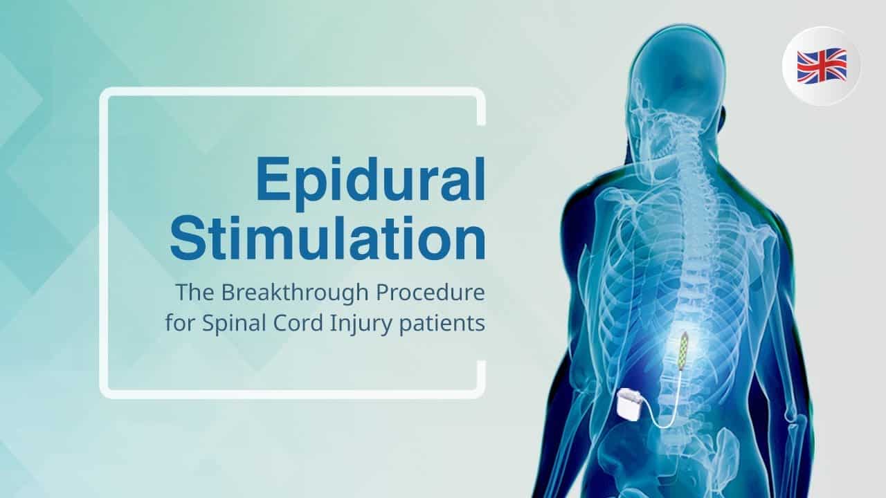 Epidural Stimulation Treatment | For Spinal Cord Injury