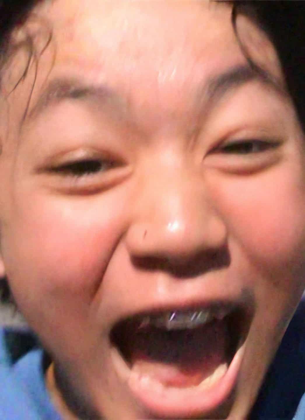 An out of focus closeup of a young Asian boy with braces, with his mouth open excitedly, with a gray street in the background.
