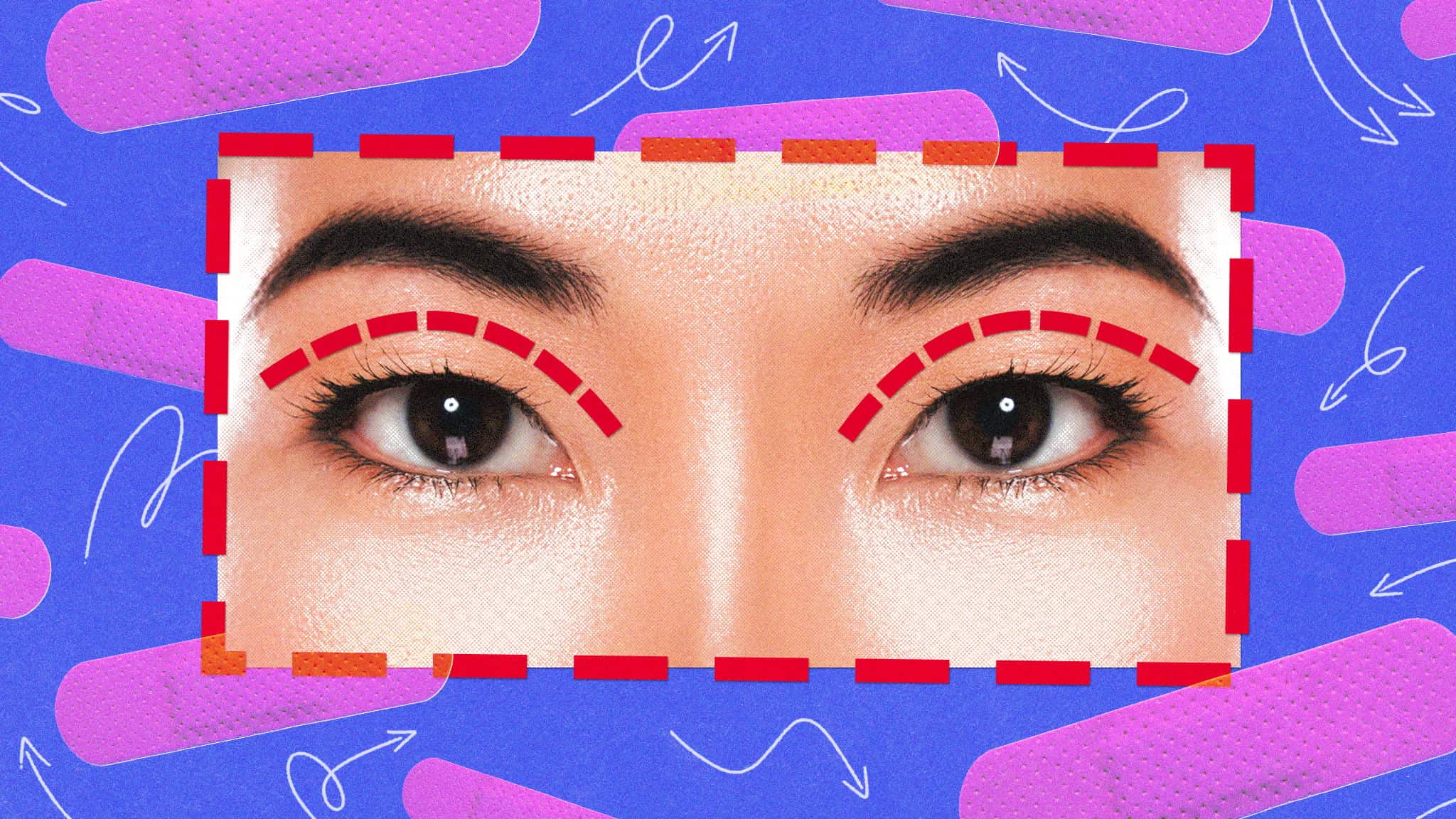 A close-up of a persons eyes with red dotted lines above the eyelids, on a blue background with pink bandages and white arrows.