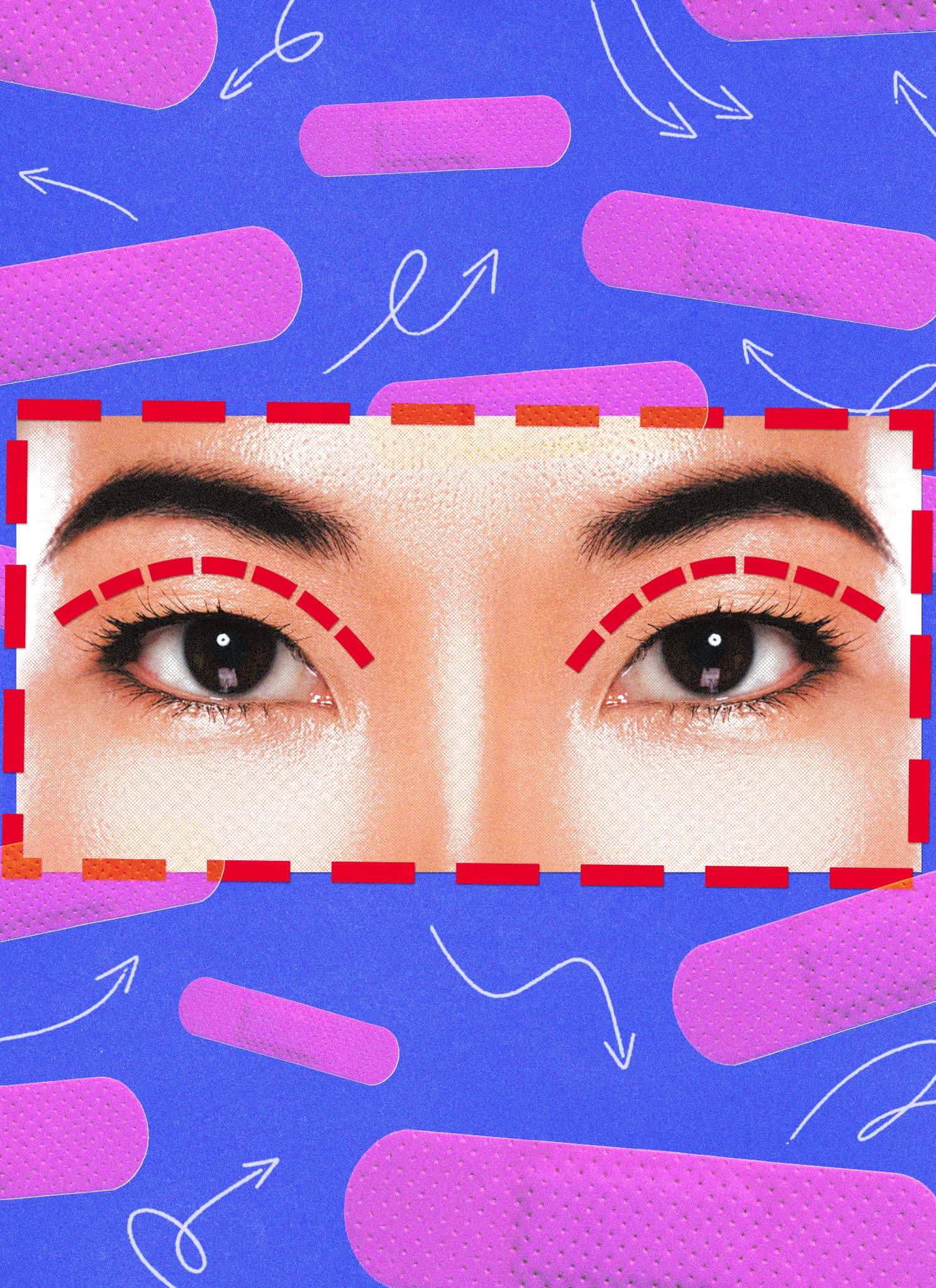 A close-up of a persons eyes with red dotted lines above the eyelids, on a blue background with pink bandages and white arrows.