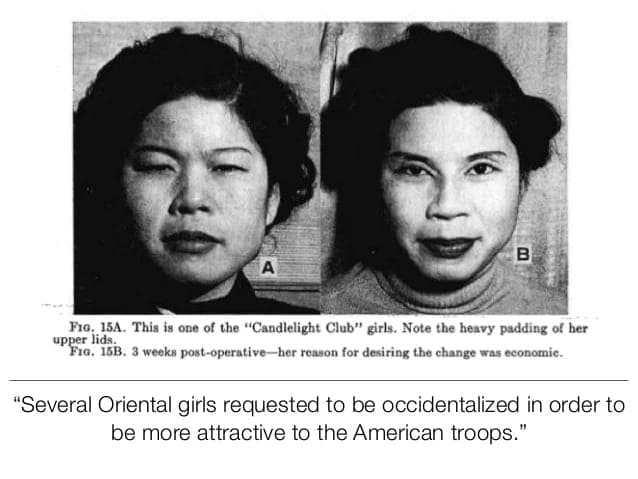 Two black-and-white photos of an Asian woman: left shows her before surgery, right shows her after surgery, looking different. Caption discusses requests for appearance changes to appeal to American troops.