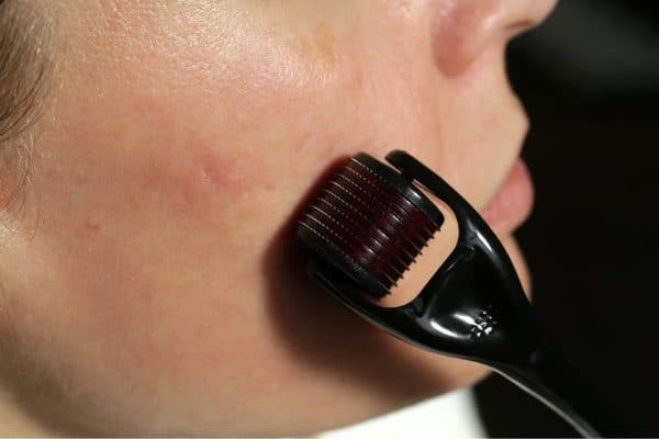 femme utilise microneedling