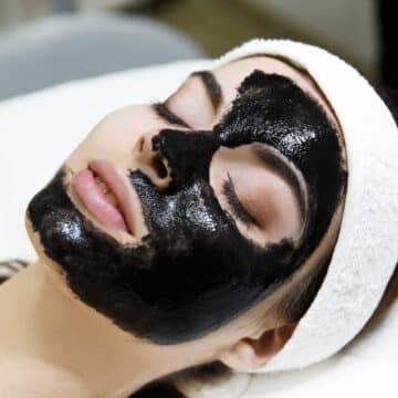 How Chemical Peels Help in Treating Acne and Scarring?