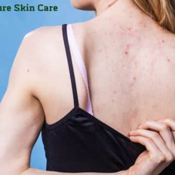 What is a Back Facial, and Who Should Get Them?