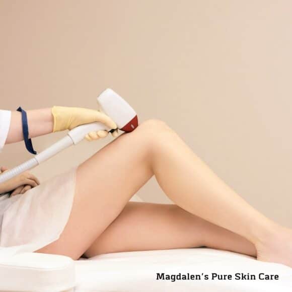 The Perfect Derma Peel in Rockville, MD