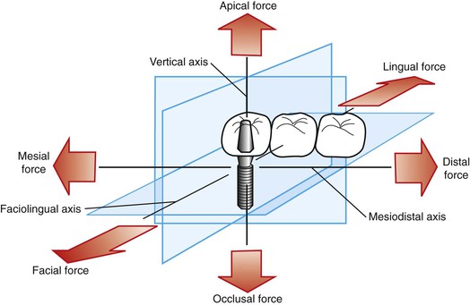 Biomechanics dental occlusion diagram