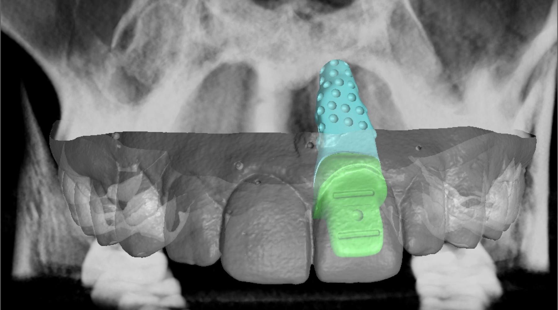 dental workflow dashboard, case tracking portal, VCAD digital transparency system