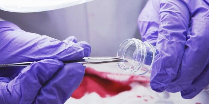 Съдебна медицина в Сливен – медицински специалист работи с лабораторен контейнер и инструмент