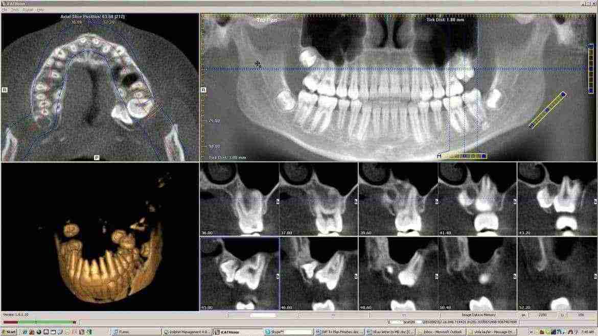 Mese Della Prevenzione Dentale