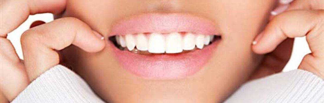 Denti bianchi e luminosi grazie allo sbiancamento dentale dello Studio Dentistico Paola Del Bianco
