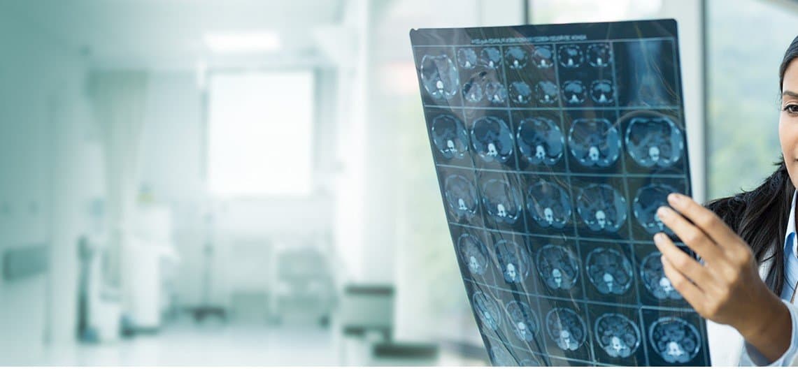 conebeam dentalscan