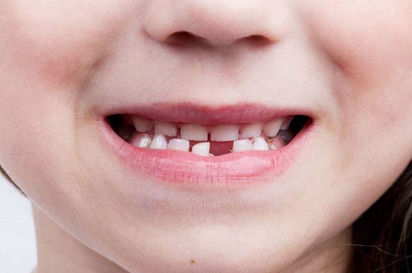 A Lucca la Cura dei denti da latte e prevenzione pediatrica presso lo Studio Dentistico Del Bianco