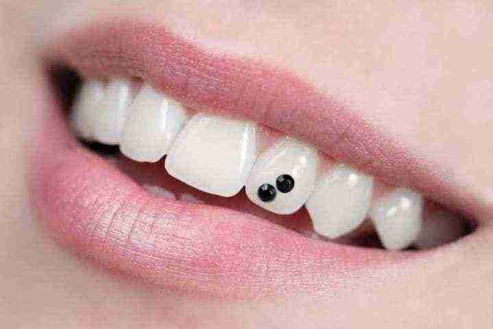 Brillantino al dente