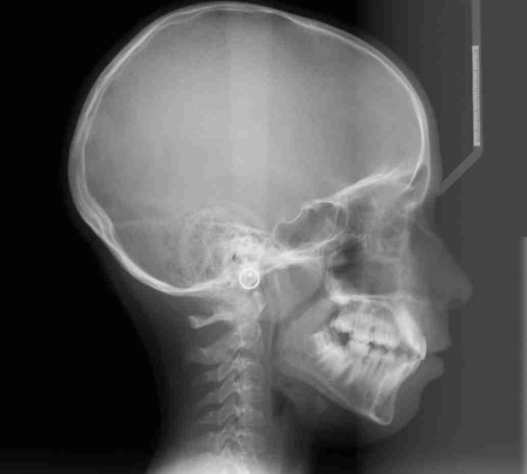 Esami radiologici in ortodonzia