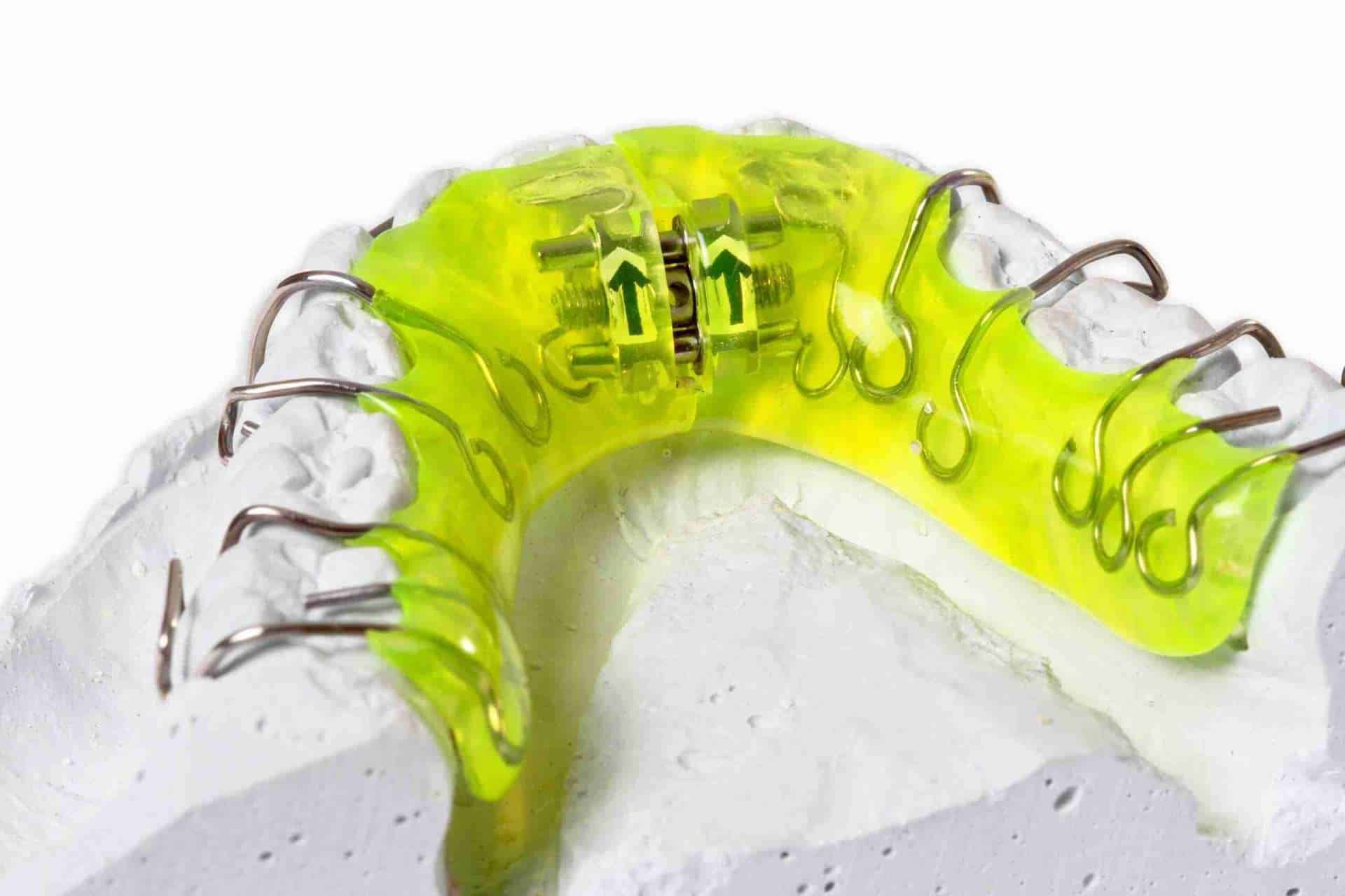 apparecchio ai denti.