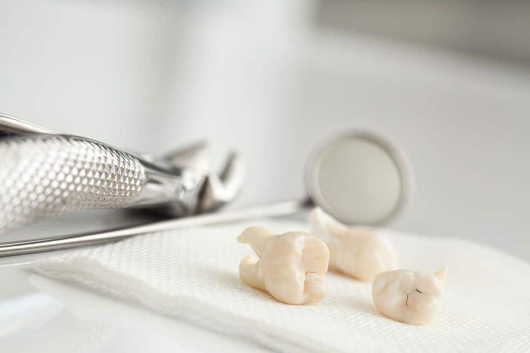 denti del giudizio