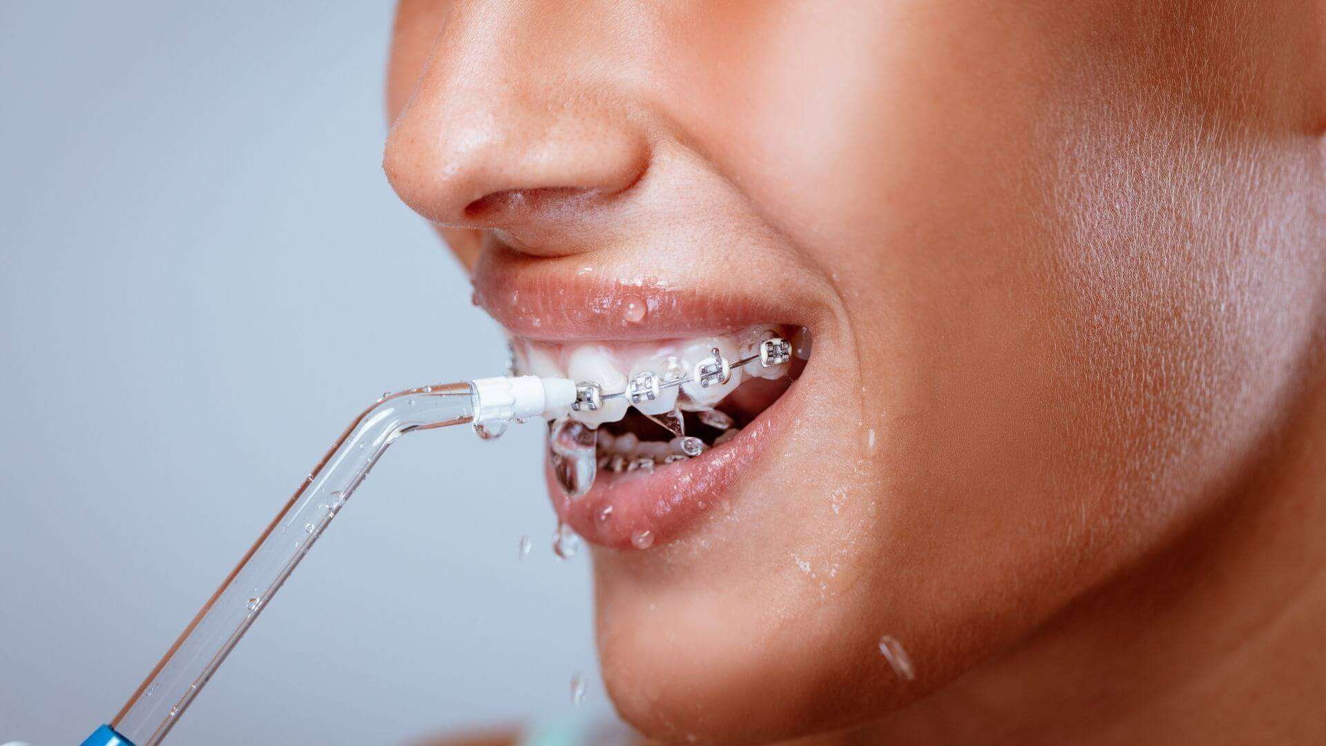 idropulsore dentale