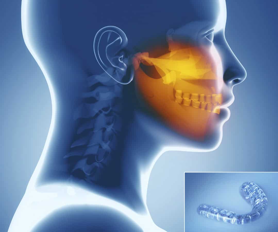 Visita gnatologica specialistica a Lucca per la cura del bruxismo presso lo Studio Dentistico Del Bianco.