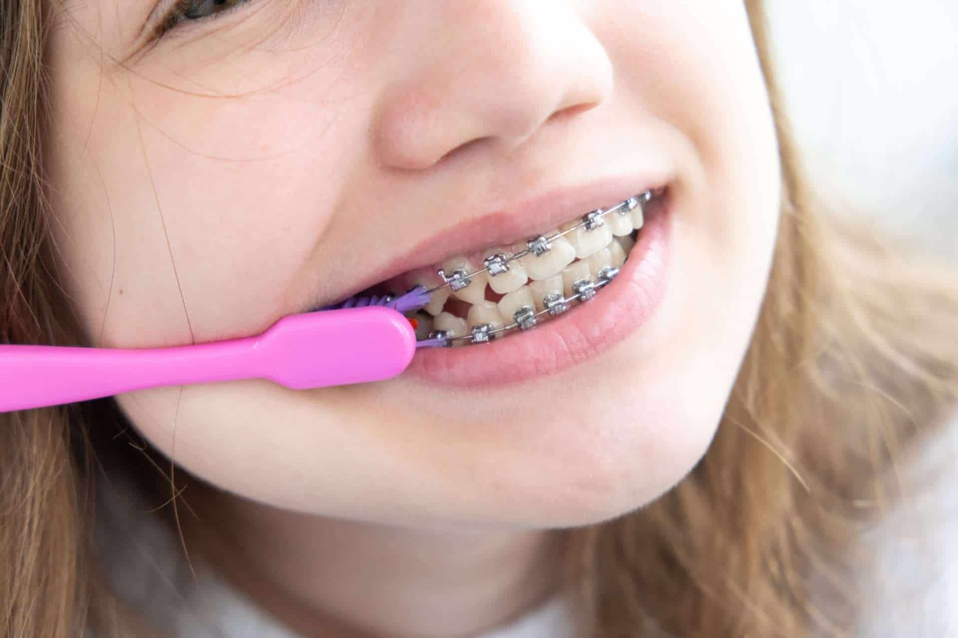 Mese Della Prevenzione Dentale