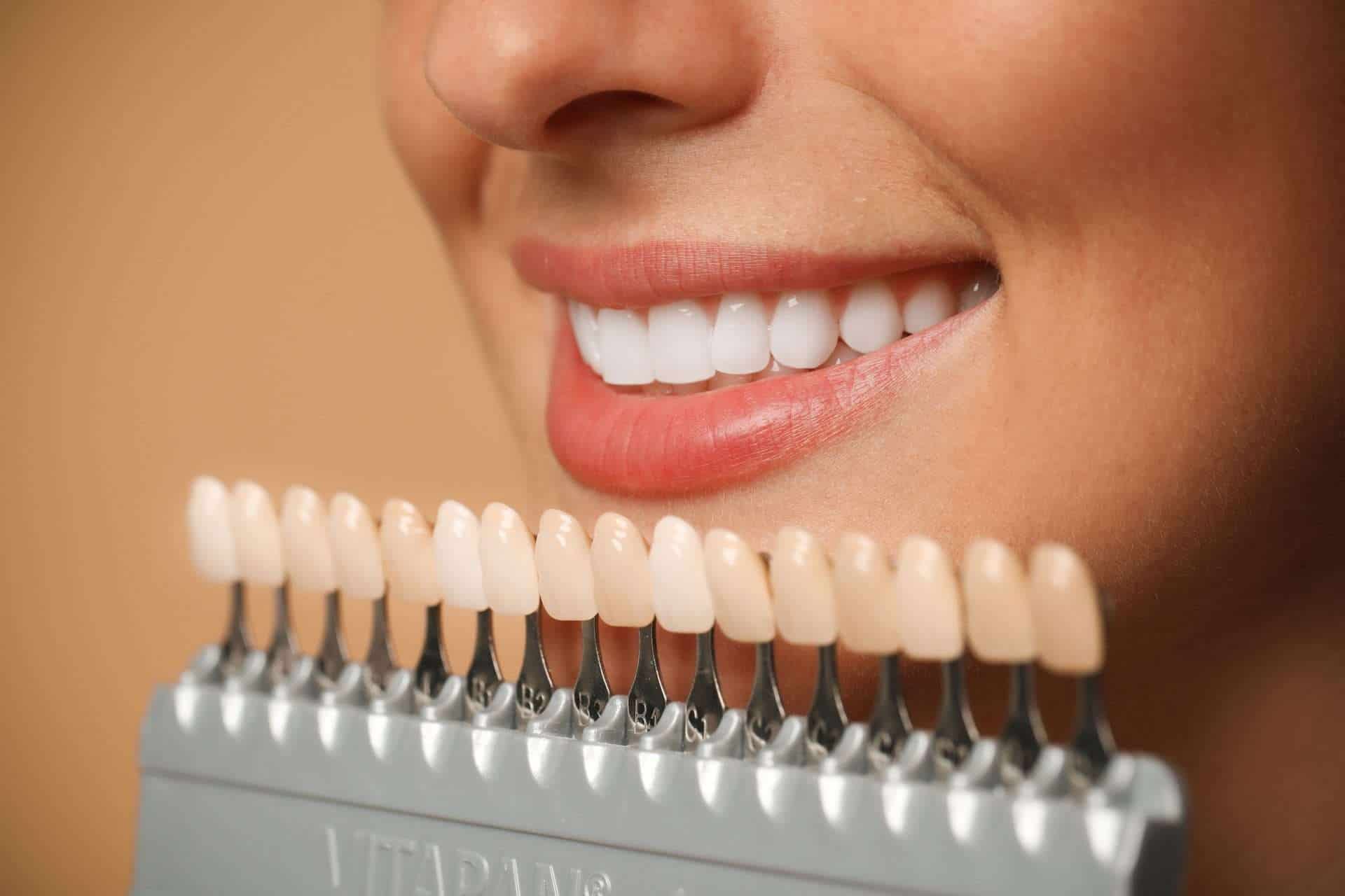 Mese Della Prevenzione Dentale