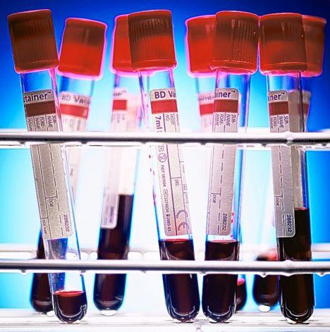 Blood samples
