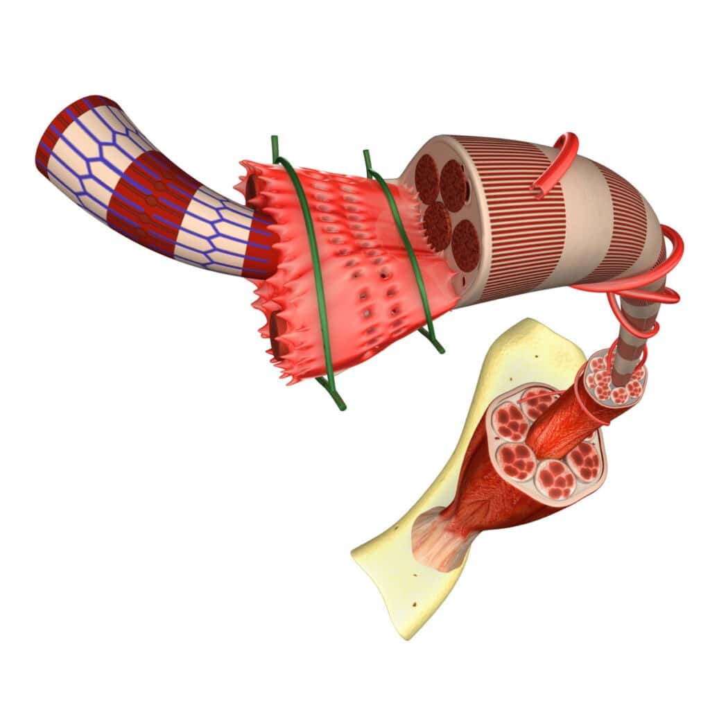 an illustration of muscle fibers and how they receive microscopic tears during strenuous exercise.