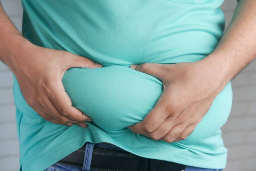 An overweight male wearing a teal shirt squeezing his stomach fat. Obesity is one of the causes for varicose veins