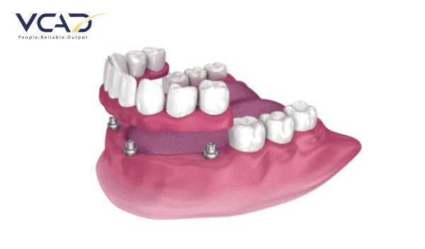 innovations-in-dental-restoration-techniques-1