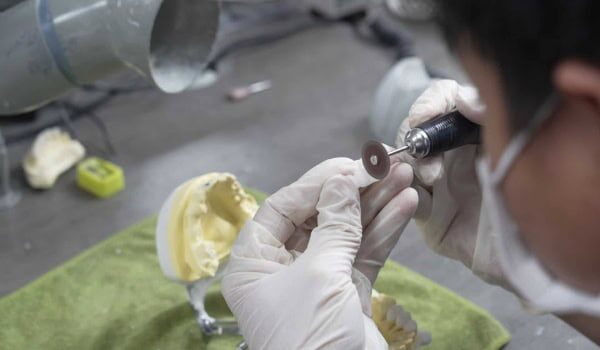 A high-quality denture made in a dental lab