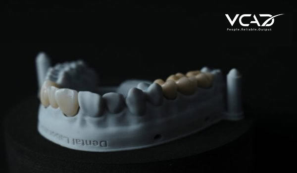 Zirconia dental ceramics