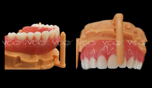 Csae Study: Upper Denture - Walter Sun