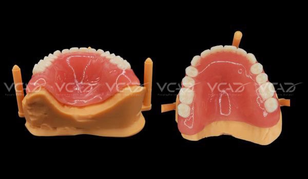 Casse study: Upper Denture - Walter Sun