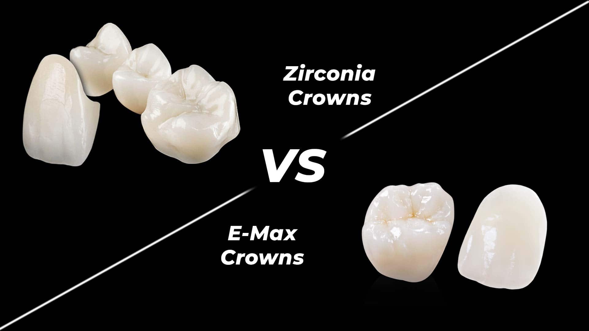 E-Max vs Zirconium