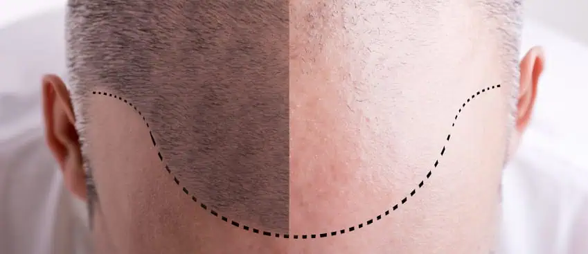 how long for hair to regrow?