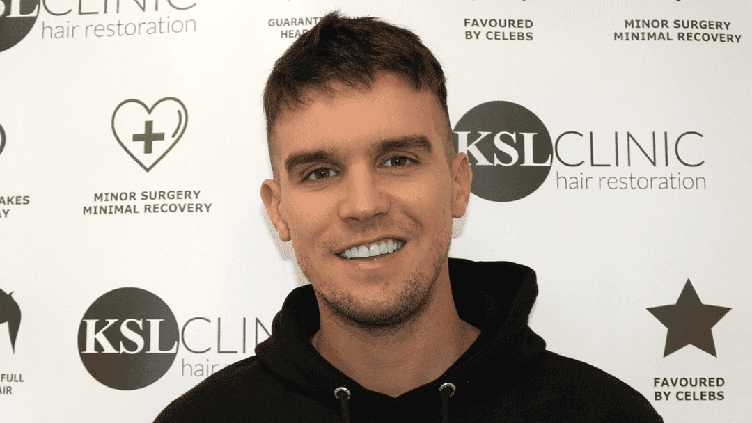 KSL CLINIC GAZ BEARD TRANSPLANT